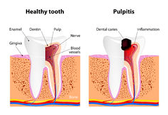 endodontija